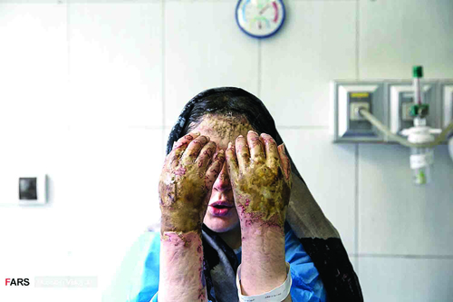 گسترش حملات اسیدی در شمال غرب گسترش حملات اسیدی در شمال غرب